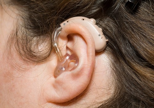 Does the Hearing Loss Association in Los Angeles Provide Audiology Services?